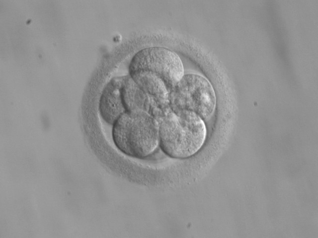 Bagaimana Embrio Transfer? Inilah Pengertianya Secara Lengkap
