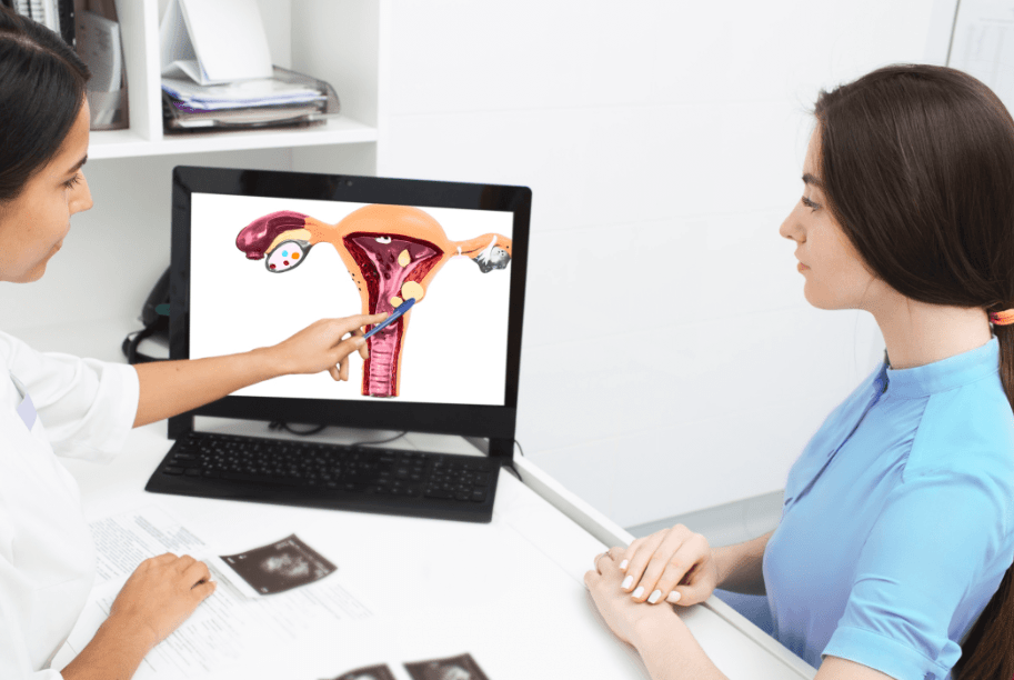 uterine fibroid adalah