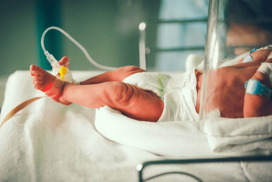 Ketahuilah 5 Penyebab Bayi Prematur Guna Mencegahnya