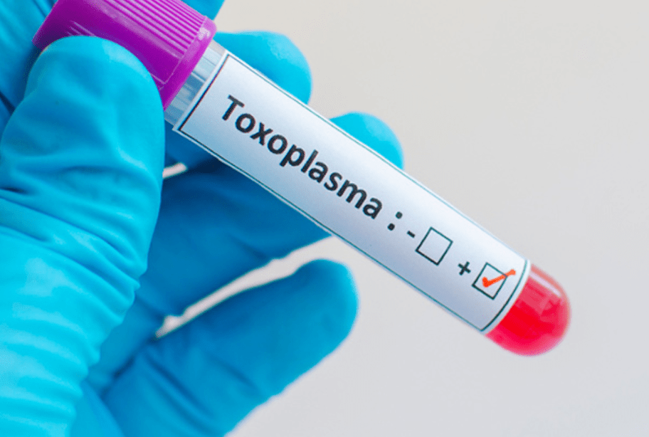 Apa Itu Toxoplasma? Simak Penjelasan Lengkapnya Di Sini