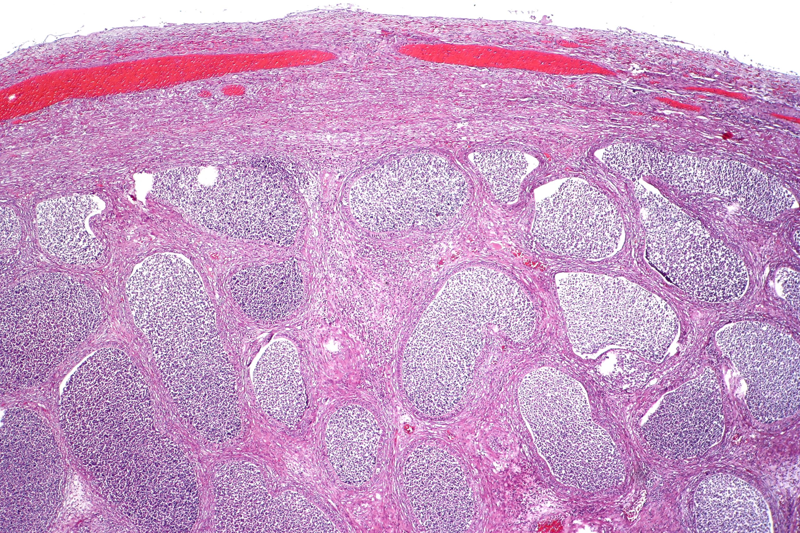 Ini 7 Cara Mencegah Epididimitis yang Harus Anda Tahu 4 cara mencegah epididimitis