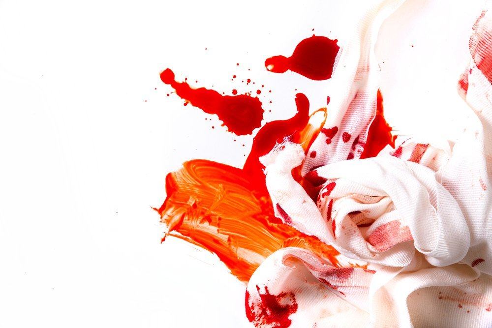 gejala kista ovarium