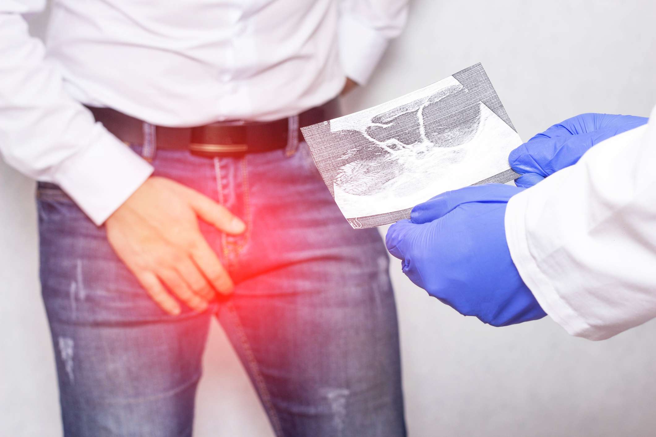 Apa Itu Hidrokel? Kenali Gejala dan Penyebabnya Sejak Dini