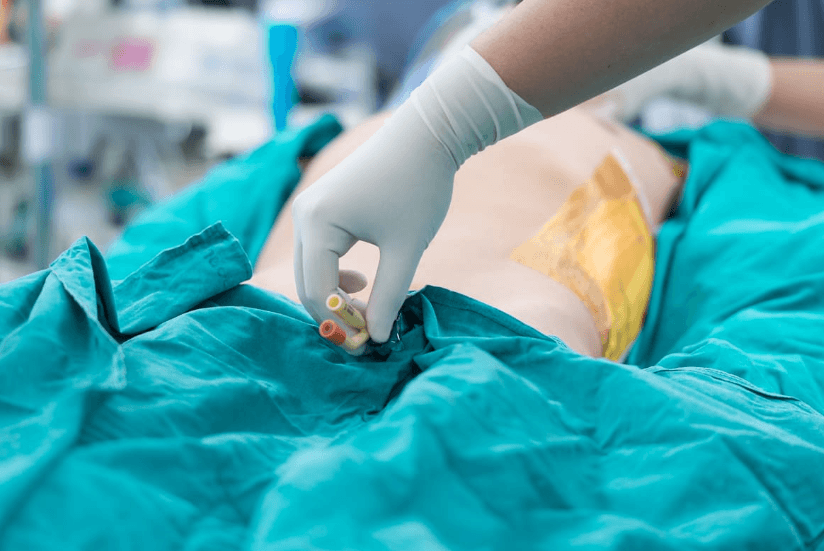 penyebab infeksi saluran kemih