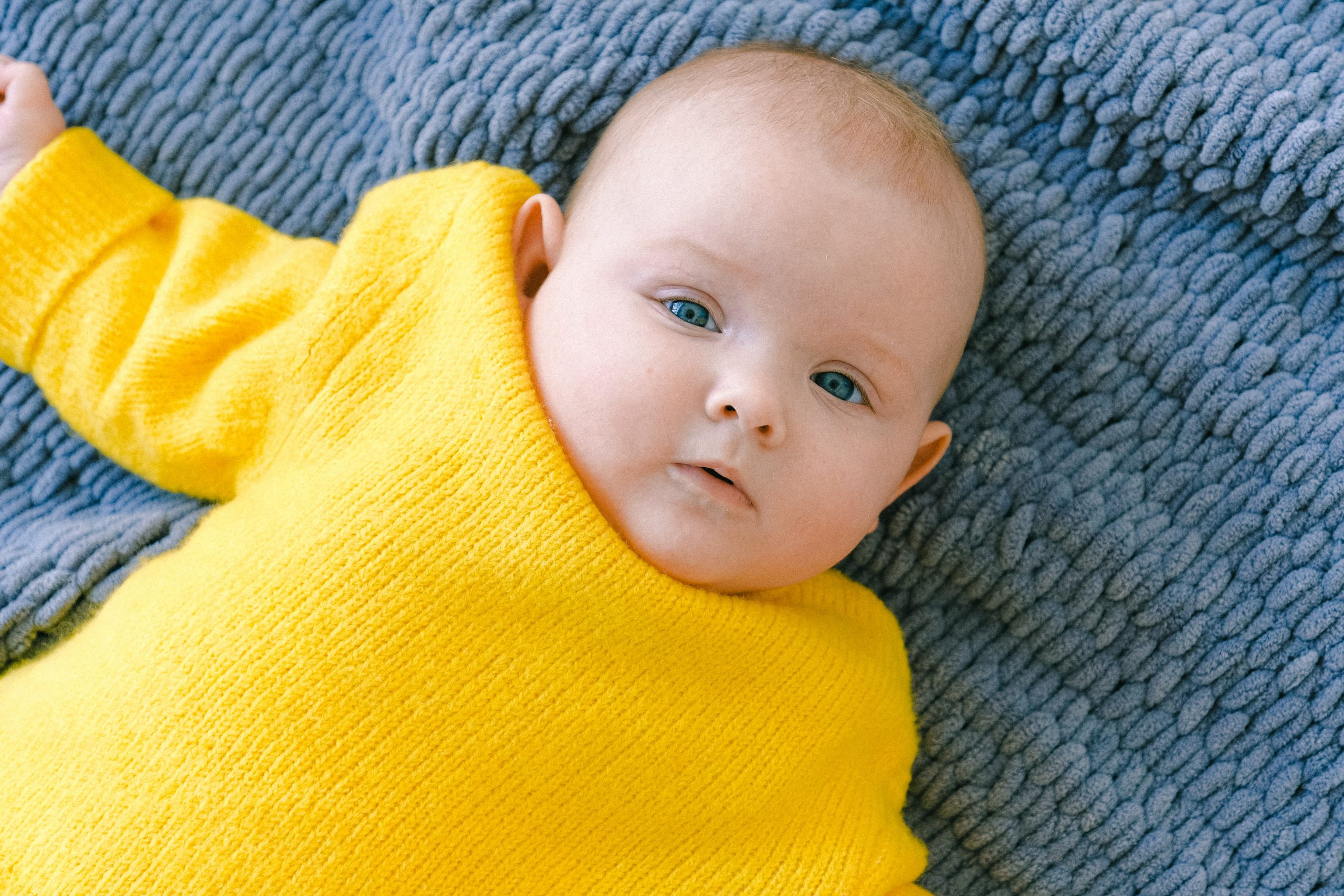 Ini Dia Penyebab Bayi Kuning dan Cara Mengatasinya