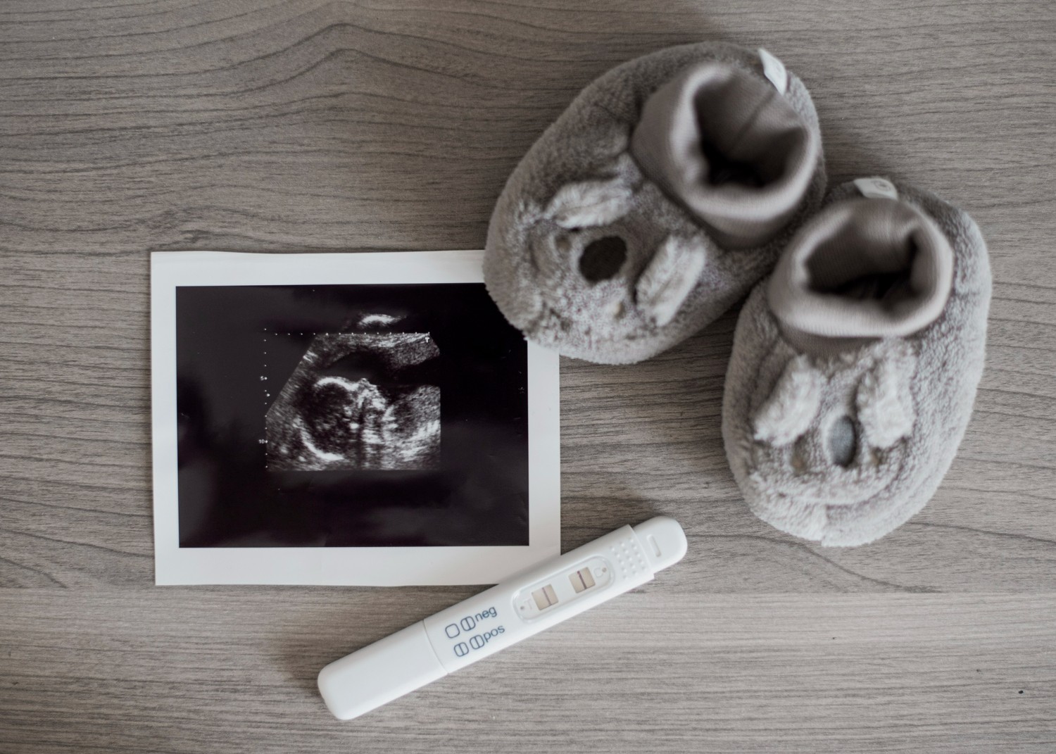 Get to know the calcification of the placenta, the symptoms, and how to prevent