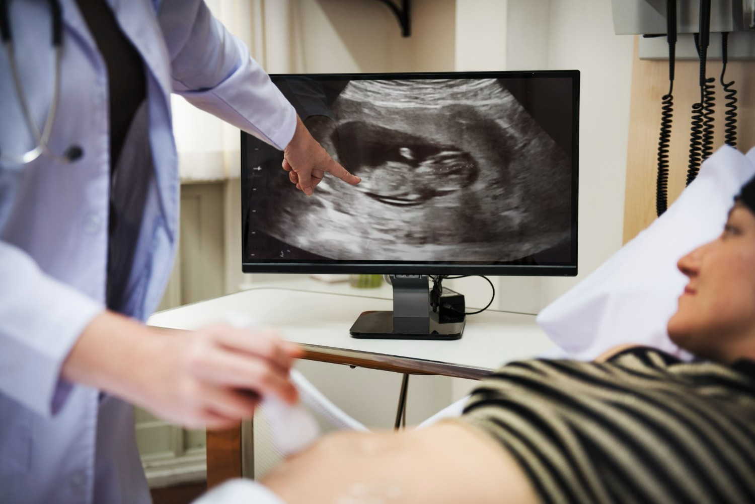 Get to Know 4 dimensional ultrasound, its Benefits, and How to Read the Results