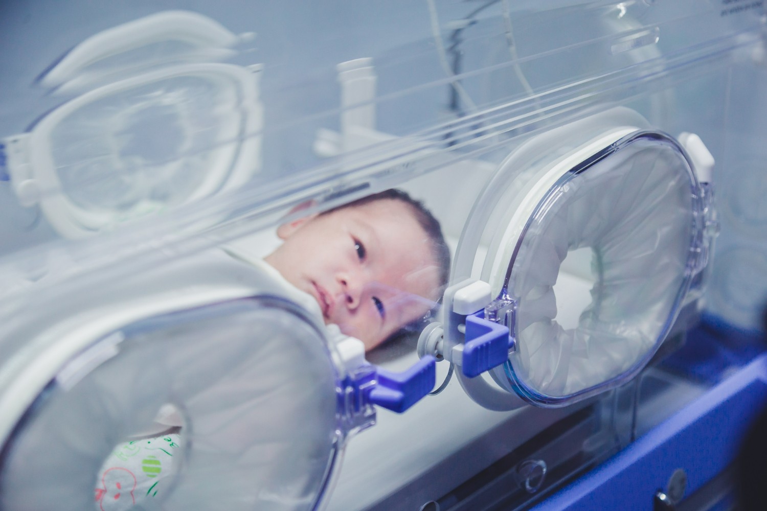 Mengenal Inkubator Bayi Prematur dan Manfaatnya