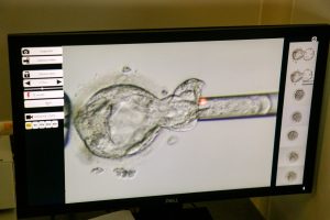 Talasemia Merupakan Penyakit Keturunan, Hindari dengan Lakukan Deteksi Dini: Skrining & PGT-M
