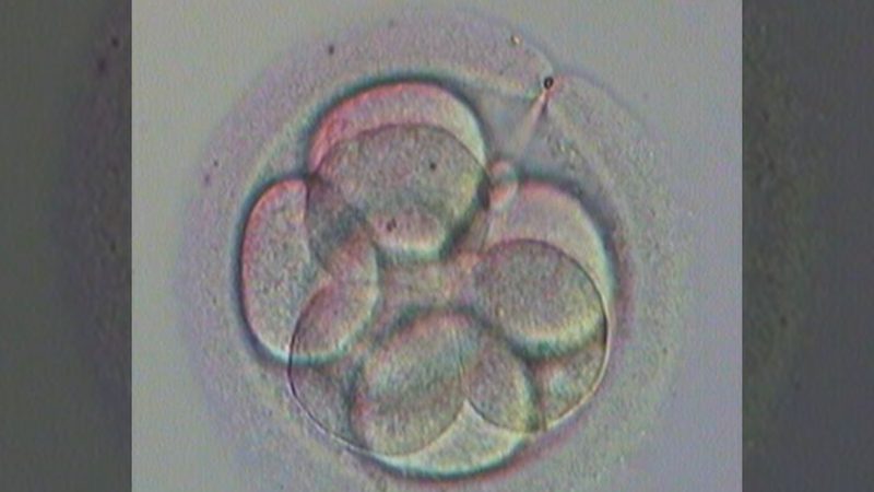 Penetasan Embrio Berbantu (Assisted hatching)