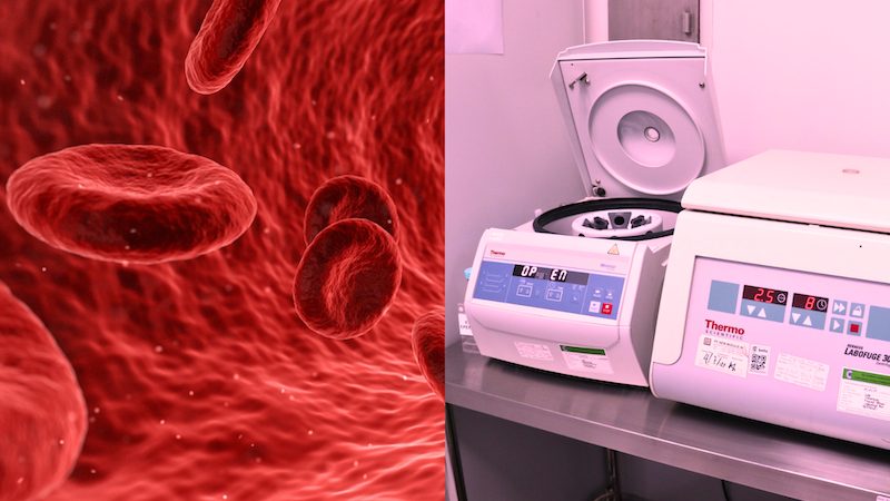 Platelets Rich Plasma (PRP) Ovarium