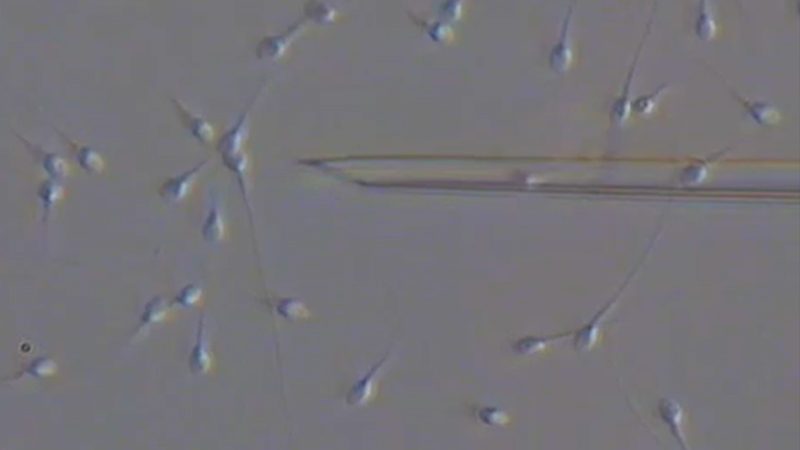 PICSI (Physiological Intracytoplasmic Sperm Injection)