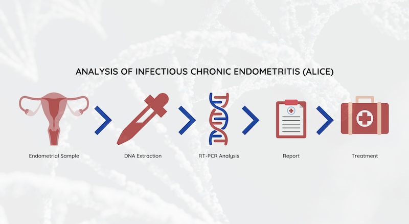 Analysis of Infectious Chronic Endometritis (ALICE)