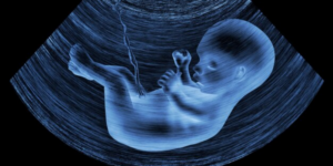 Intrauterine Growth Restriction (IUGR), Kondisi Pertumbuhan Janin yang Terhambat