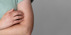 Penyebab Kolestasis pada Ibu Hamil dan Cara Mengatasinya