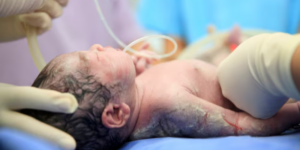 Asfiksia Neonatorum: Penyebab, Gejala, dan Penanganannya