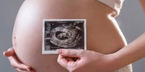 Bayi Terlilit Tali Pusar, Penyebab dan Penanganannya