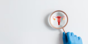 Sulit Hamil Karena Lubang Serviks Kecil?