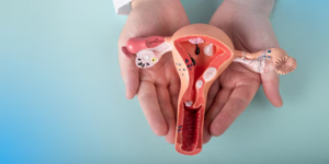 Servisitis: Penyebab, Gejala, dan Pengobatannya