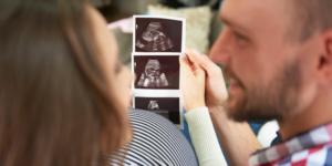 Cara Membaca Hasil USG Kehamilan dengan Mudah dan Akurat