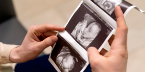 Penyebab Janin Stres dalam Kandungan dan Cara Mengatasinya