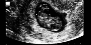 Perkembangan Janin 7 Minggu: Apa yang Terjadi?