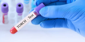 Pentingnya Tes TORCH untuk Kehamilan Sehat