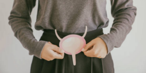 Kanker Kandung Kemih – Penyebab, Gejala dan Pengobatan