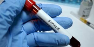 Waspadai Sifilis: Gejala, Penyebab, dan Pengobatannya