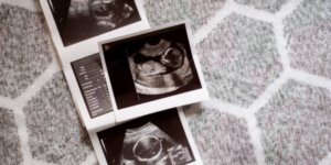 Perkembangan Janin dan Ciri Sehat Hamil 6 Bulan