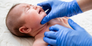 Hipotiroid Kongenital: Penyebab, Gejala dan Penanganannya