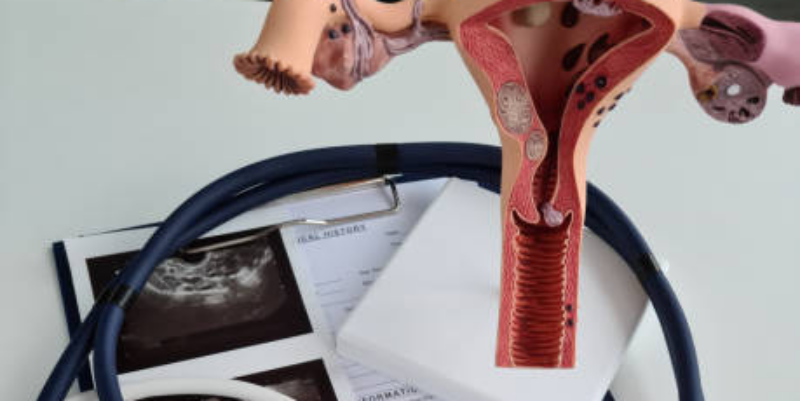 Bra Nyaman untuk Ibu Hamil