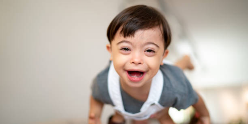 Penyebab Bayi Down Syndrome