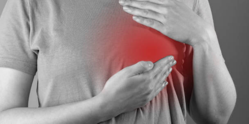 Abses Payudara: Gejala, Penyebab & Cara Mengobati