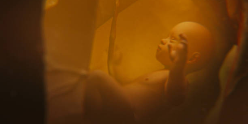 Waspadai Bahaya Air Ketuban Berwarna Hijau