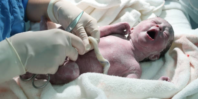 Manfaat Delayed Cord Clamping dan Risikonya