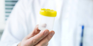 Sperma Berwarna Kuning, Pertanda Apa?