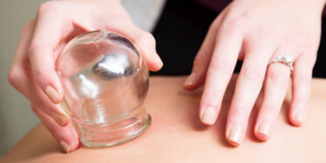 Apakah Bekam Aman Dilakukan Selama Kehamilan?