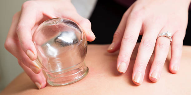 Apakah Bekam Aman Dilakukan Selama Kehamilan?