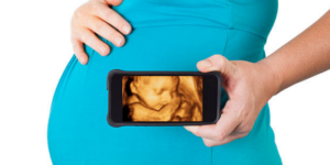 Keluhan Ibu Hamil Trimester 3 dan Cara Mengatasinya